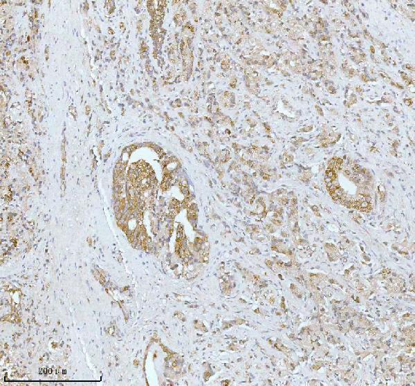 a05096 1 soat1 primary antibodies ihc testing 4