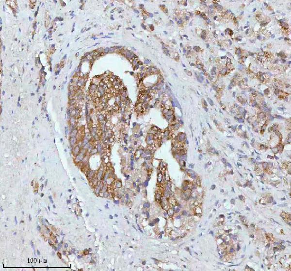 a05096 1 soat1 primary antibodies ihc testing 5