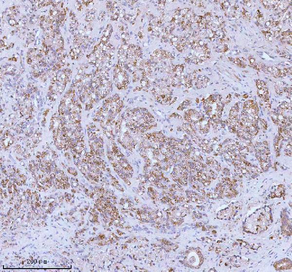 a05096 1 soat1 primary antibodies ihc testing 6