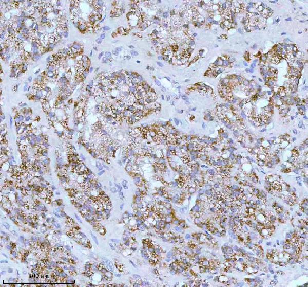 a05096 1 soat1 primary antibodies ihc testing 7