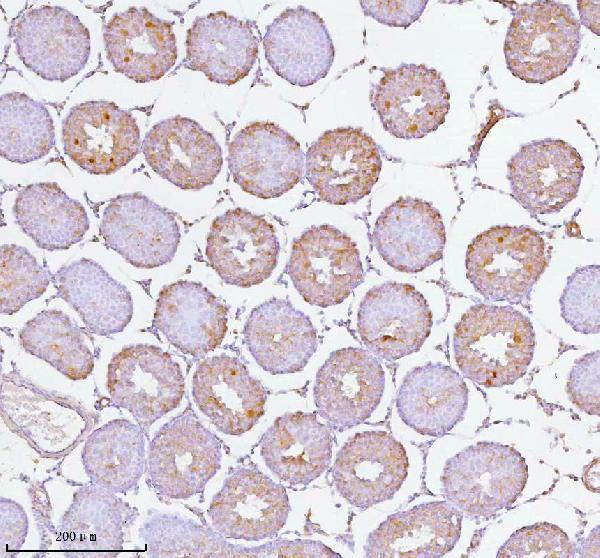 a05096 1 soat1 primary antibodies ihc testing 8