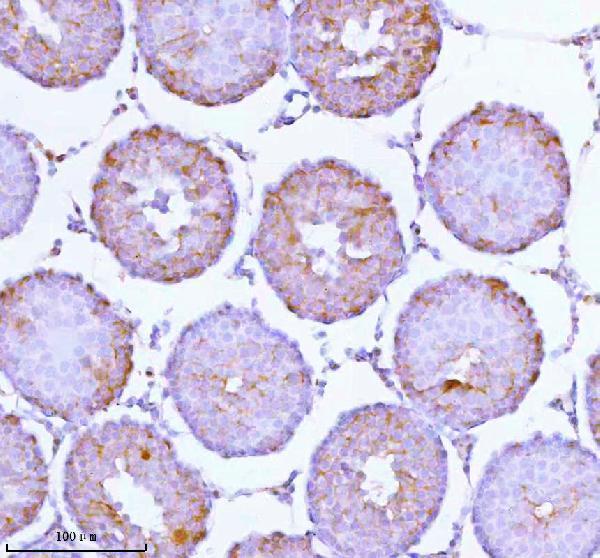 a05096 1 soat1 primary antibodies ihc testing 9