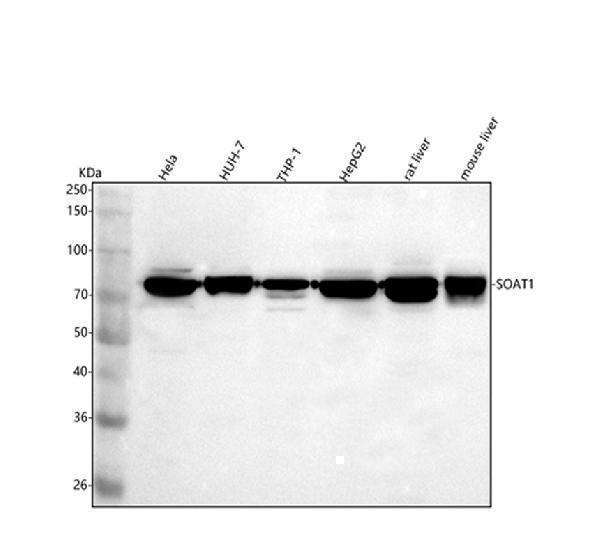  Western blot analysis of SOAT1 using anti-SOAT1 antibody (A05096-1)