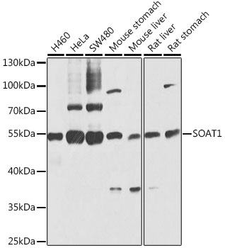 WesternBlot (WB) analysis of SOAT1 polyclonal antibody