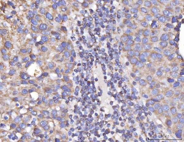 a05097 1 dlst primary antibodies ihc testing 3