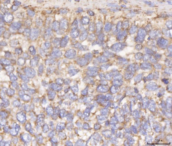 a05097 1 dlst primary antibodies ihc testing 5