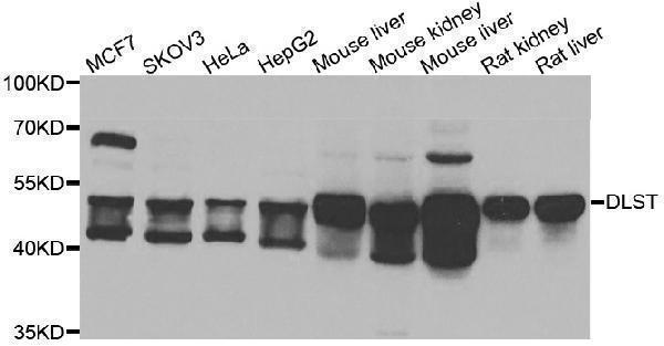 a05097 dlst primary antiboties wb testing 1