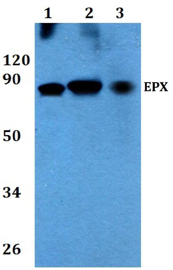 a05098 epx primary antiboties wb testing 1