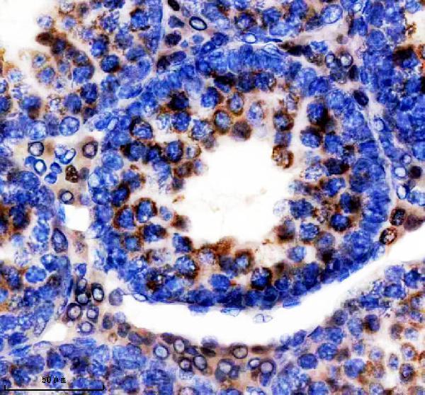 IHC analysis of CRAT using anti-CRAT antibody (A05101-1)