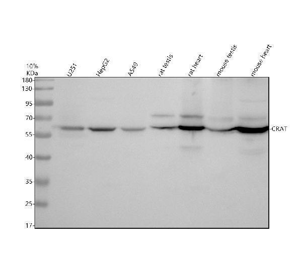 Western blot analysis of CRAT using anti-CRAT antibody (A05101-1)