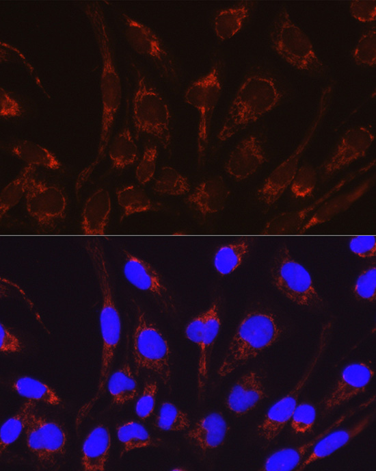 Immunofluorescence analysis of RD cells using CRAT Rabbit pAb  at dilution of 1:50 