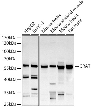 Western blot analysis of extracts of various cell lines, using CRAT   antibody  at 1:500 dilution