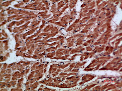 Immunohistochemistry validation of ARTN using Anti-Artemin Artn Antibody (A05102-1)