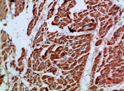 Immunohistochemistry validation of ARTN using Anti-Artemin Artn Antibody (A05102-1)