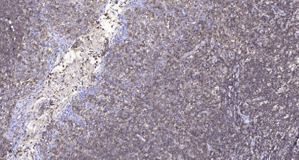a05103 prkg2 primary antibodies ihc testing 1