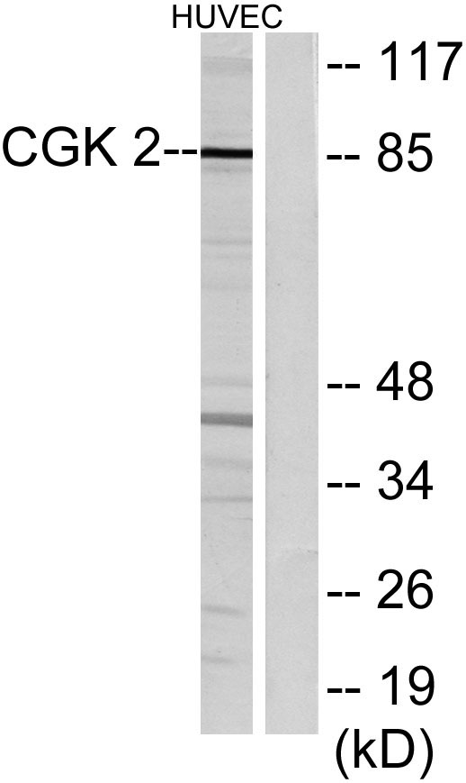 Western blot analysis of lysates from HUVEC cells, using CGK 2 Antibody