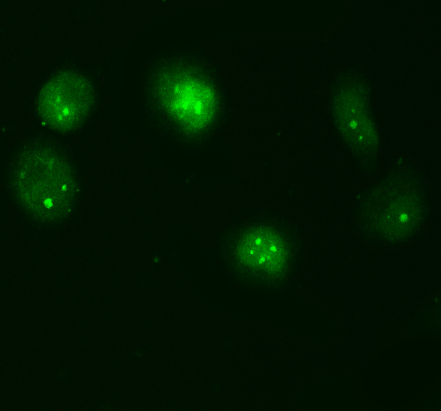 a05105 1 psmb4 primary antibodies if testing 1