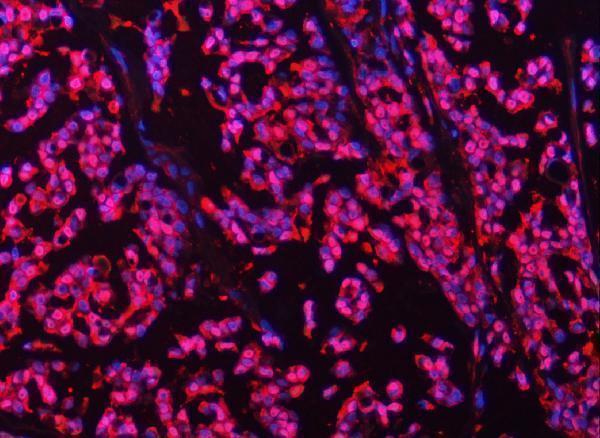 a05105 1 psmb4 primary antibodies if testing 10