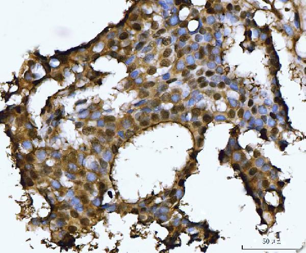  IHC analysis of PSMB4 using anti-PSMB4 antibody (A05105-1)