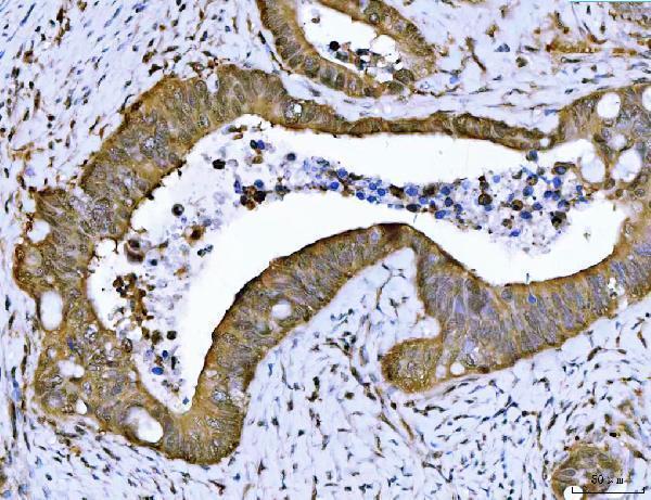  IHC analysis of PSMB4 using anti-PSMB4 antibody (A05105-1)