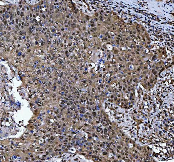 a05105 1 psmb4 primary antibodies ihc testing 4