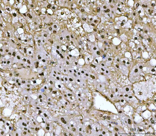 a05105 1 psmb4 primary antibodies ihc testing 5