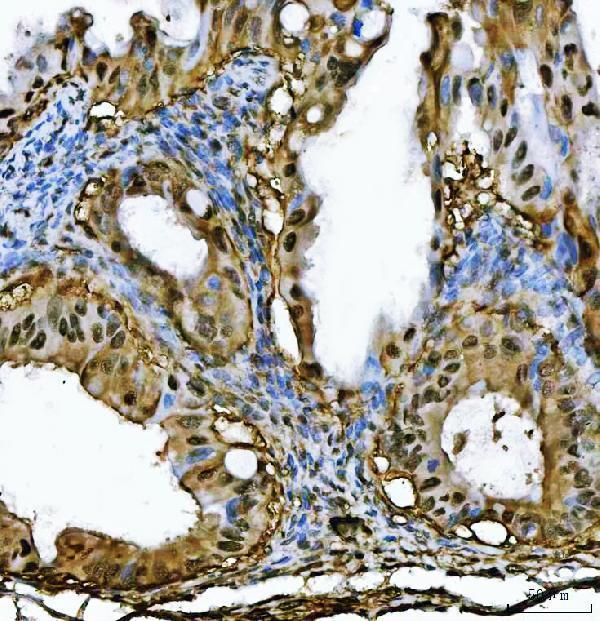 a05105 1 psmb4 primary antibodies ihc testing 6