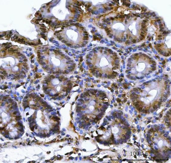 a05105 1 psmb4 primary antibodies ihc testing 7