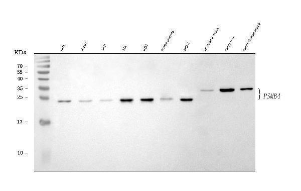  Western blot analysis of PSMB4 using anti-PSMB4 antibody (A05105-1)