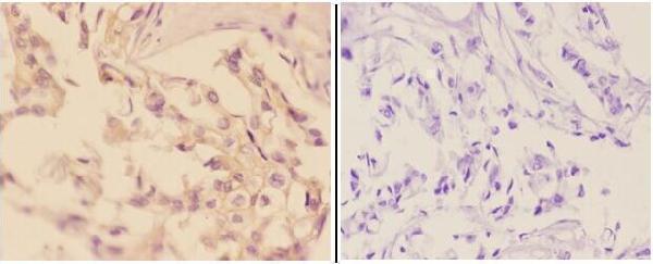 a05106 1 add2 primary antiboties ihc testing 2