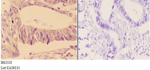 a05106 1 add2 primary antiboties ihc testing 3
