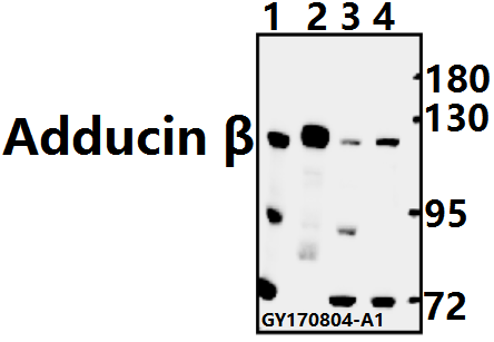 a05106 1 add2 primary antiboties wb testing 1