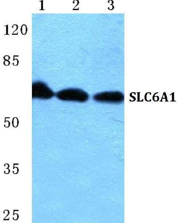 Western blot (WB) analysis of SLC6A1 polyclonal antibody at 1:500 dilution
Lane1:Hela cell lysate
Lane2:Raw264