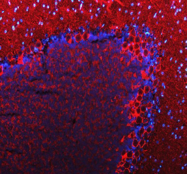 a05109 slc6a1 primary antibodies if testing 2