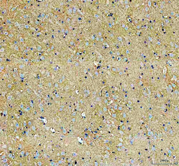 a05109 slc6a1 primary antibodies ihc testing 3