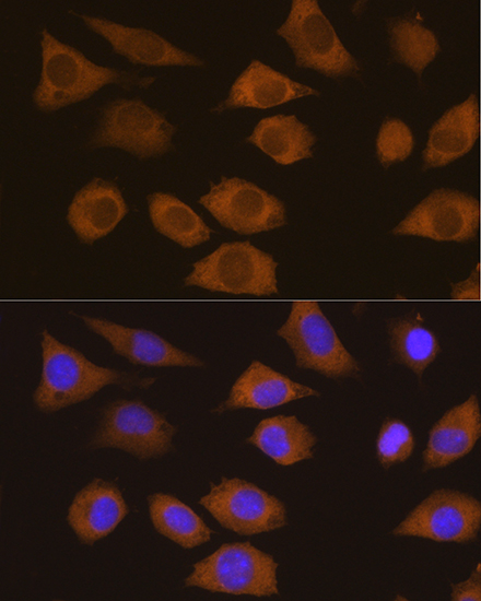a05114 csde1 primary antiboties if testing 2