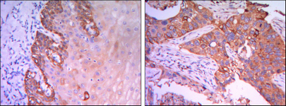a05115 rab25 primary antibodies ihc testing 3