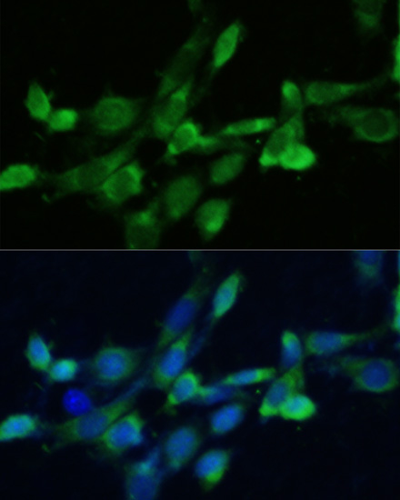 a05118 fdft1 primary antiboties if testing 4