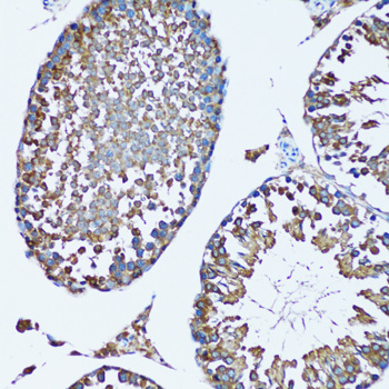 a05118 fdft1 primary antiboties ihc testing 2