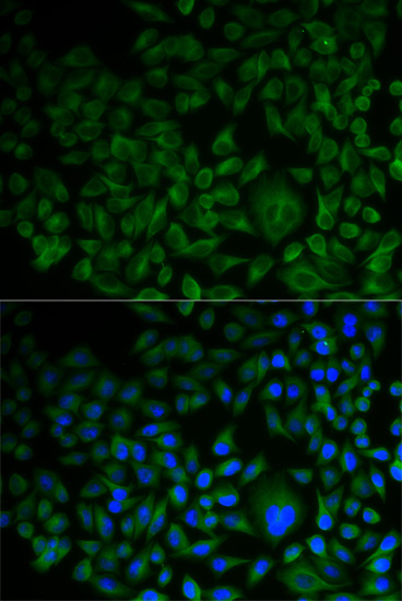 a05118 fdft1 primary antiboties ihc testing 3