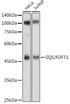 a05118 fdft1 primary antiboties wb testing 1