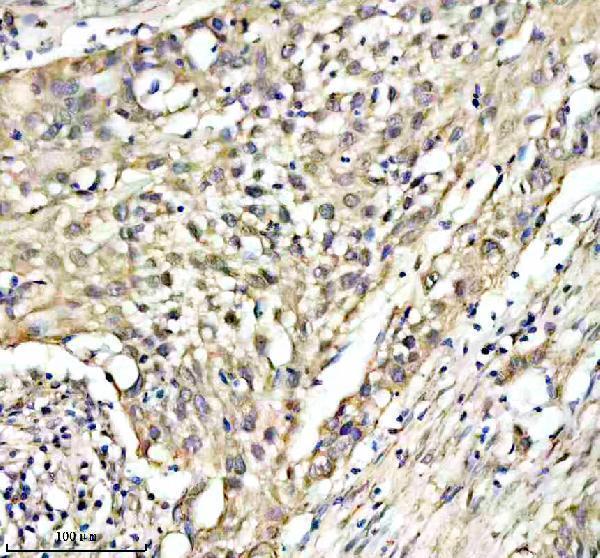  IHC analysis of RARRES3/PLAAT4 using anti-RARRES3/PLAAT4 antibody (A05119-1)
