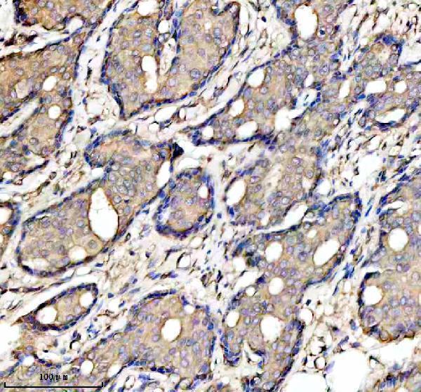  IHC analysis of RARRES3/PLAAT4 using anti-RARRES3/PLAAT4 antibody (A05119-1)