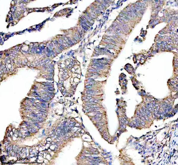 a05119 1 plaat4 primary antibodies ihc testing 4