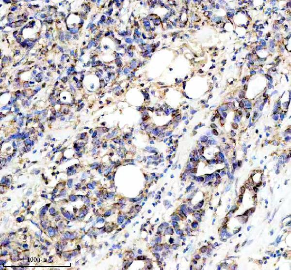 a05119 1 plaat4 primary antibodies ihc testing 5