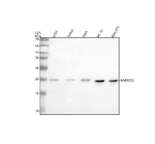  Western blot analysis of RARRES3/PLAAT4 using anti-RARRES3/PLAAT4 antibody (A05119-1)