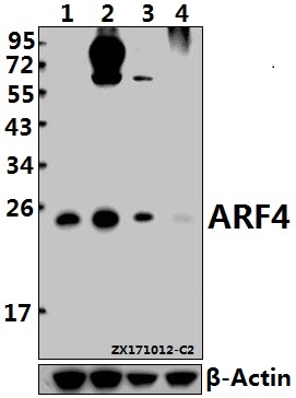 Western blot (WB) analysis of ARF4 (E106) pAb at 1:500 dilution
Lane1:HepG2 whole cell lysate(40ug)
Lane2:K562 whole cell lysate(40ug)
Lane3:L02 whole cell lysate(40ug)
Lane4:3T3-L1 whole cell lysate(40ug)
