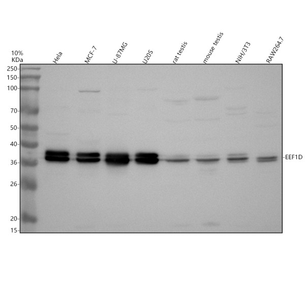 Western blot analysis of EEF1D using anti-EEF1D antibody (A05123-1)