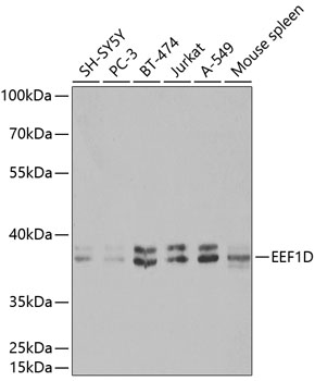 Western blot (WB) analysis of EEF1D polyclonal antibody