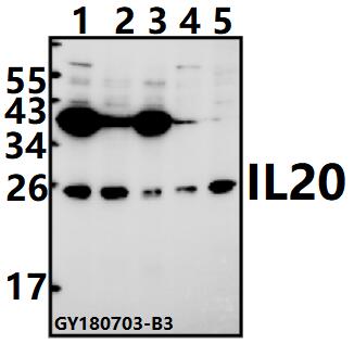 Western blot (WB) analysis of IL20 pAb at 1:500 dilution
Lane1:A375 whole cell lysate(40ug)
Lane2:PC3 whole cell lysate(40ug)
Lane3:MCF-7 whole cell lysate(40ug)
Lane4:PMVEC whole cell lysate(40ug)
Lane5:3T3-L1 whole cell lysate(40ug)